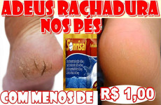 como-acabar-com-as-rachaduras-dos-pes-09-1011