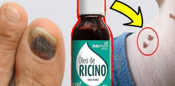 O que quase ninguém sabe sobre o óleo de rícino! Porque não fiz isso antes