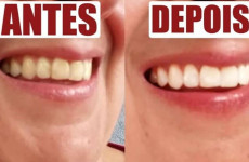 dica-para-clarear-os-dentes-1104